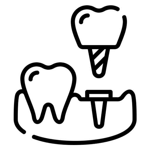 Dental implant model highlighting restorative dentistry options for optimal oral health at Warwick Dental in Oklahoma City.