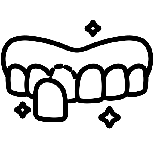 Dental veneers on a tooth, showcasing a cosmetic dentistry procedure aimed at improving the appearance of smiles and addressing issues like discoloration and misalignment.