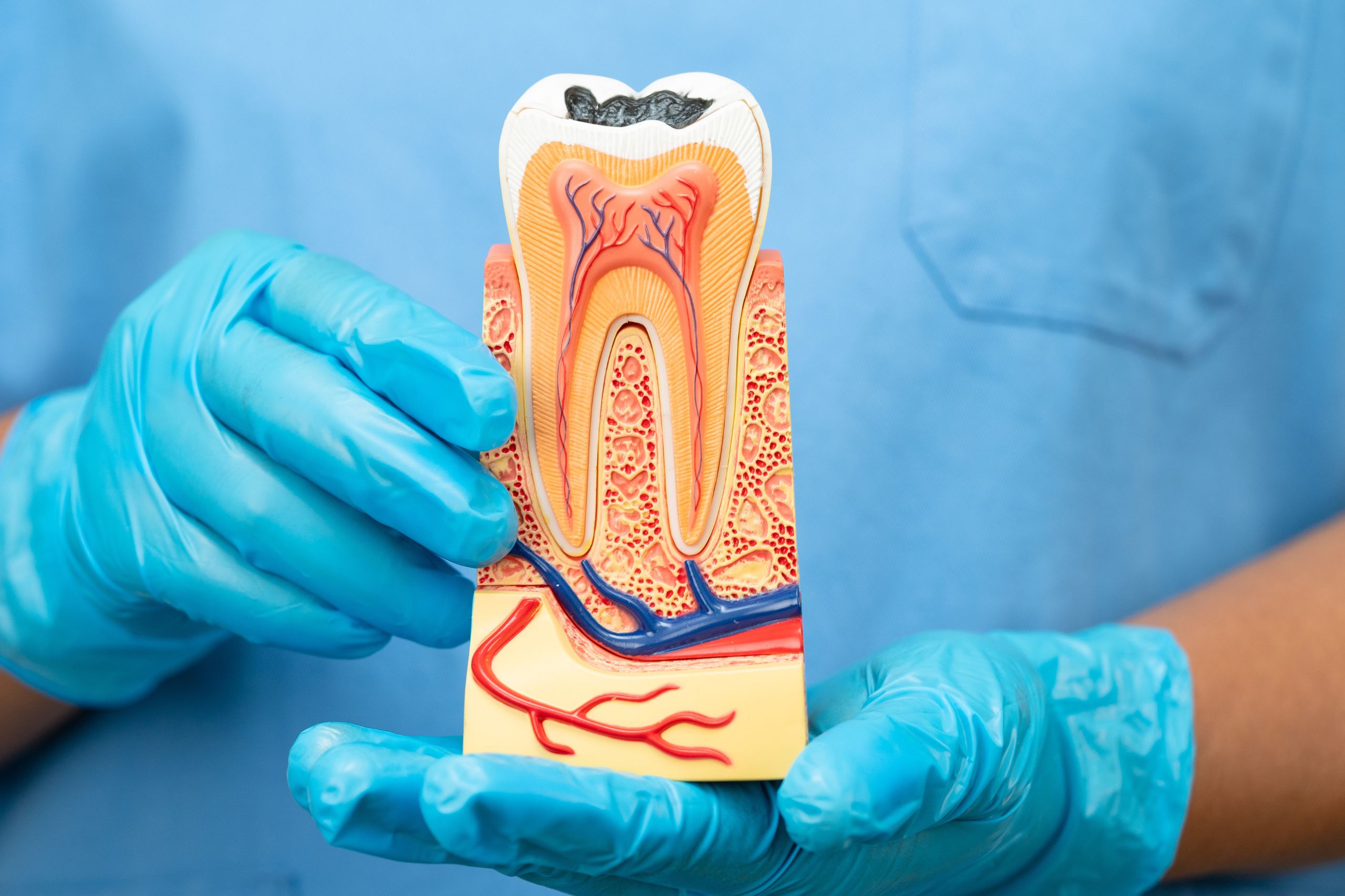 Dentist holding root canal model to explain the procedure and the recovery time