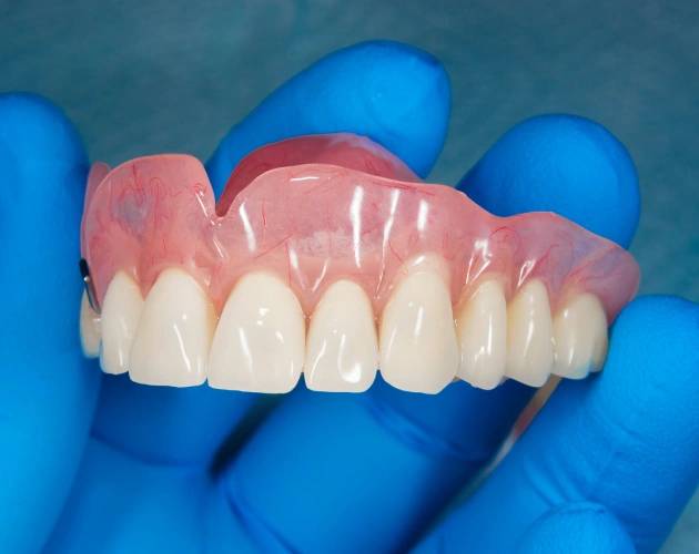 Dentist holding the custom-made dentures at Warwick Dental in Oklahoma City.
