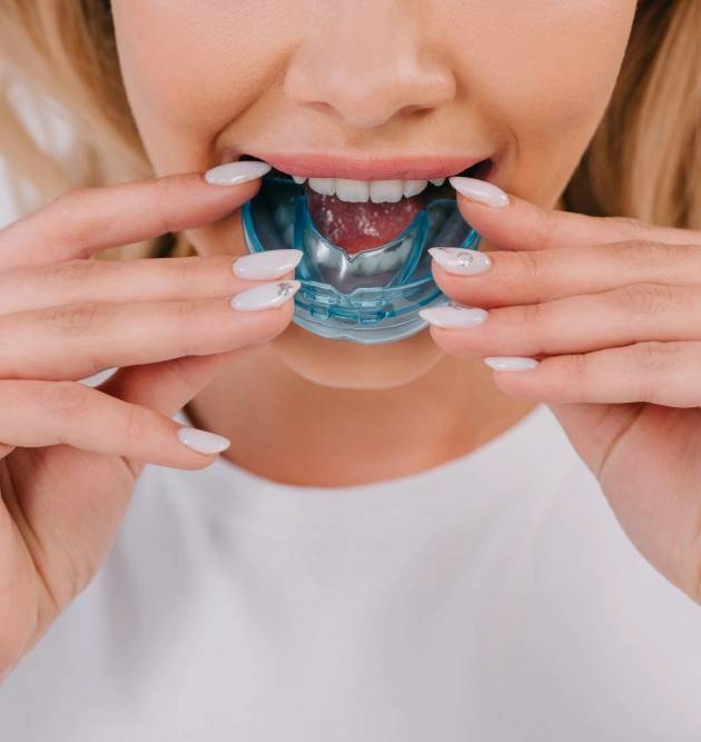 Woman preparing to insert a custom mouth guard, showcasing dental protection for athletes and bruxism management.