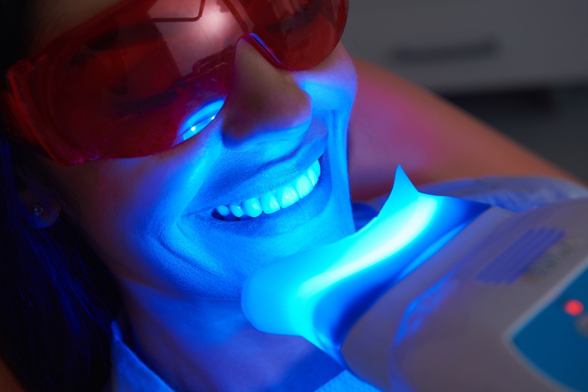 teeth whitening in Oklahoma City