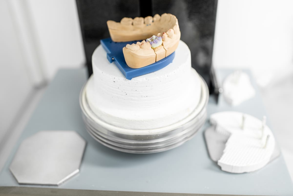 Dental Crowns in Warr Acres